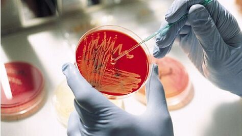 a prosztatagyulladás bakteriális tenyészete az antibiotikumok felírásához
